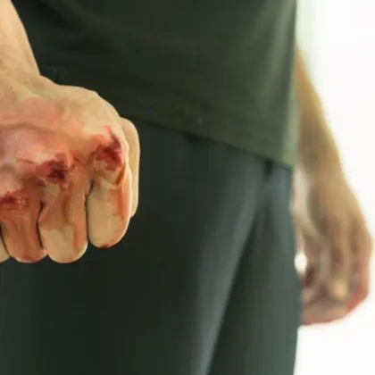 Мъже пребиха хасковлия и избягаха - издирват ги