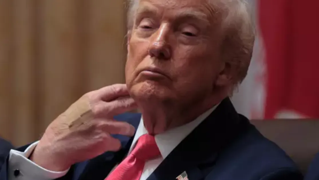 След въпроси за лепенките по ръцете на Тръмп: Белият дом посочи причината