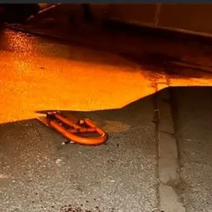 На неосветена улица: Майка се спъна в скоба и наряза ръката си СНИМКА