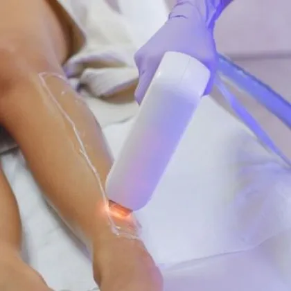 Интимни снимки от естетичните процедури на млада жена се озоваха онлайн