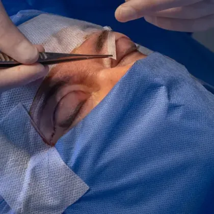 Жена се представи за пластичен хирург и обезобрази лицето на пациентка