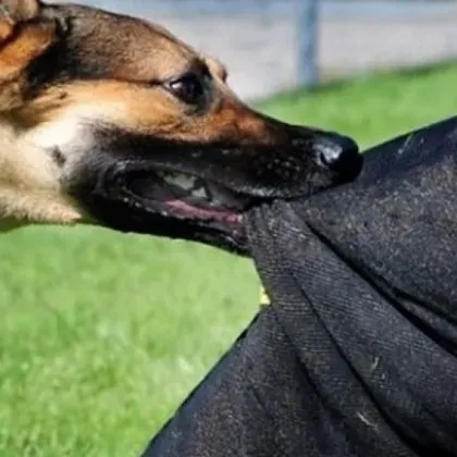 Жителка на Варна твърди че е била нападната и нахапана