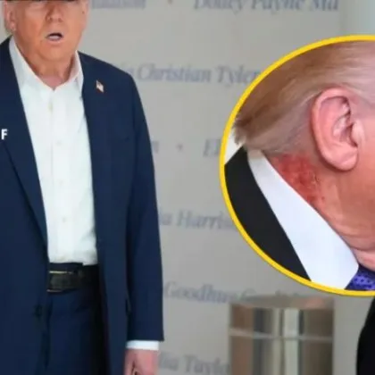 Тръмп се появи на церемония в Белия дом със странно червено петно ​​на врата си