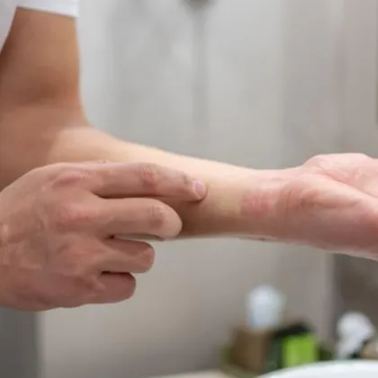 Безплатни прегледи за атопичен дерматит в УМБАЛ "Свети Георги" в Пловдив