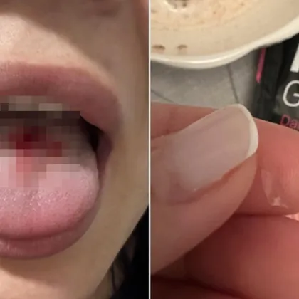 Жена твърди, че е открила парче стъкло в протеинова гранола - показва и наранен език СНИМКИ