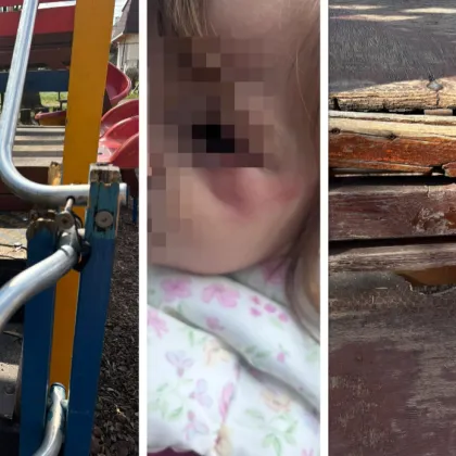 Дете пострада на детска площадка в София, майка вини общината СНИМКИ