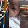 Дете пострада на детска площадка в София, майка вини общината СНИМКИ