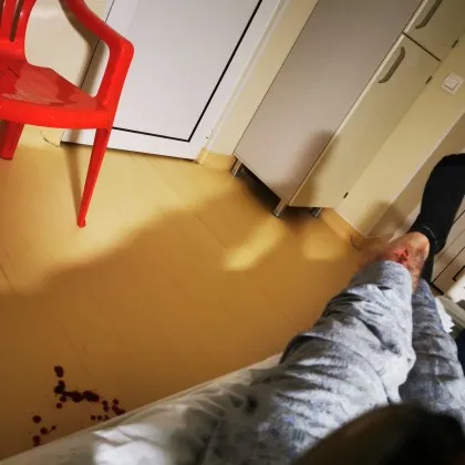 Удар в гръб и бягство: 50-годишна жена е между живота и смъртта в ИСУЛ