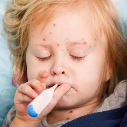 Проф. Христова: Морбили ще гори, докато има горивен материал - деца без имунитет