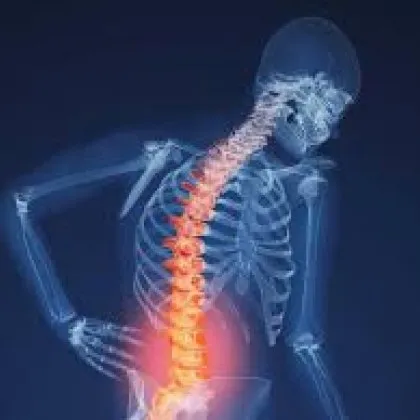 Установиха възрастта, на която костите губят здравина