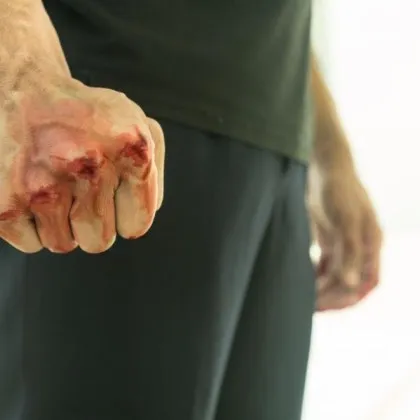 От пари за вот до побой: Двама се млатиха в Монтанско