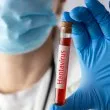 Обявиха пътниците от кораба с хантавирус за високорискови контактни лица
