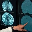 СЗО с лоша прогноза: До 2050 година случаите на рак в света ще се увеличат значително. Защо?