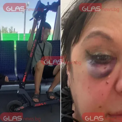 Тротинетка във влак прати жена в болница: Пострадалата с разказ пред GlasNews СНИМКИ