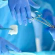 Хирурзи отстраниха 600-грамов тумор от 26-годишна жена