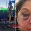 Тротинетка във влак прати жена в болница: Пострадалата с разказ пред GlasNews СНИМКИ