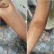 Кошмар на спирката: Дете пострада при затваряне на автобусни врати във Велико Търново