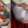 Медсестра отряза част от пръста на дете с ножица при сваляне на марля
