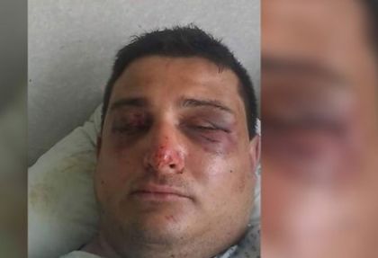Оправдаха роми, пребили зверски мъж