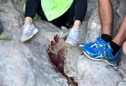 Момиче бе зарязано в локва кръв в планината, след запознанство в социалните мрежи