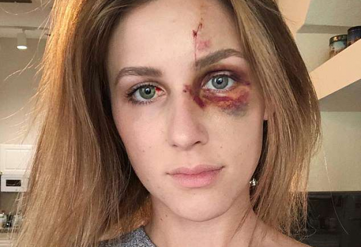 Милионерско синче спука от бой русата си приятелка, показвала си твърде много... (СНИМКИ 18+)
