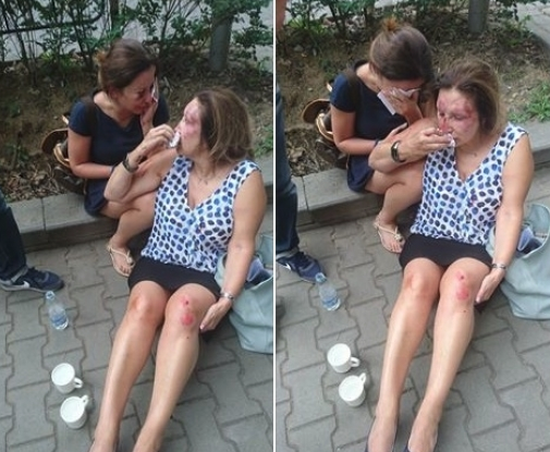 Ужас в Борисовата градина: Хулигани пребиха две жени посред бял ден (СНИМКИ)