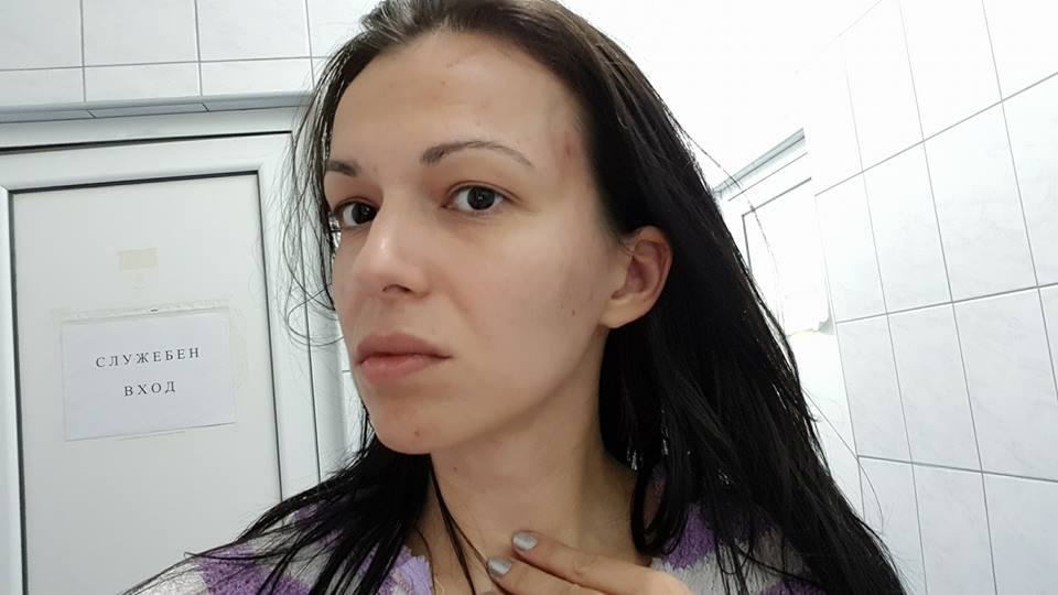 Пребиха Мис Тигрова! Тя потърсила помощ пред блока по бельо! Записала побоя на ВИДЕО!