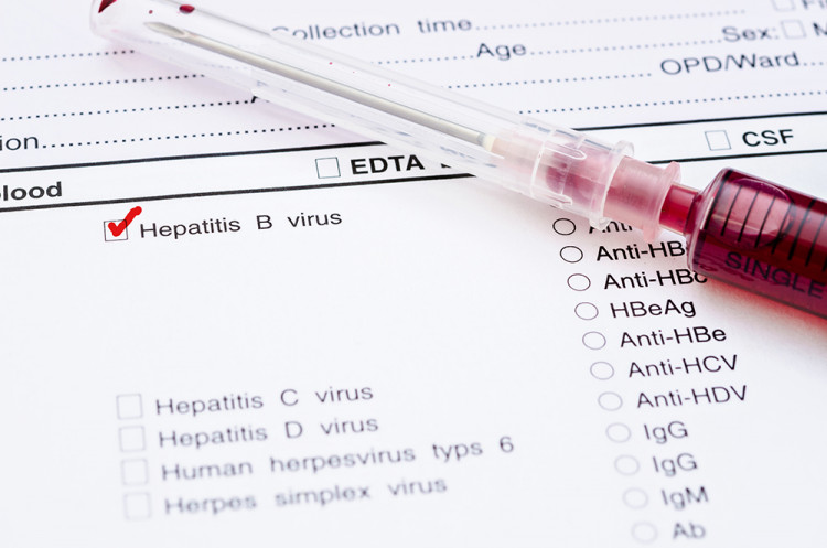 Хроничният хепатит В няма нужда от лечение?