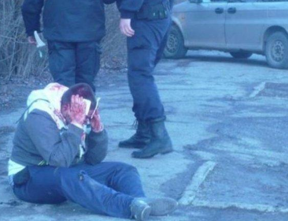 Бой до кръв за паркомясто в Бяла Слатина! Двама млатиха плевенчанин