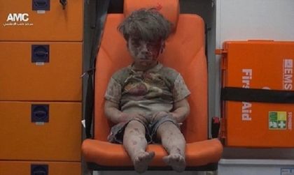 Братчето на сирийчето Омран почина от раните си в Алепо