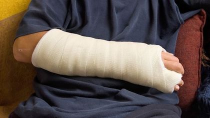 На Северозапад е като в Дивия Запад: Мъж счупи ръката на комшия при скандал