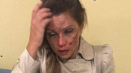 Пребитата почти до смърт Сани Алекса проговори, шведът побойник имал българите за цигани!