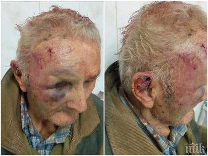 Брутална агресия! Циганин преби и ограби дядо в Славяново (СНИМКИ)