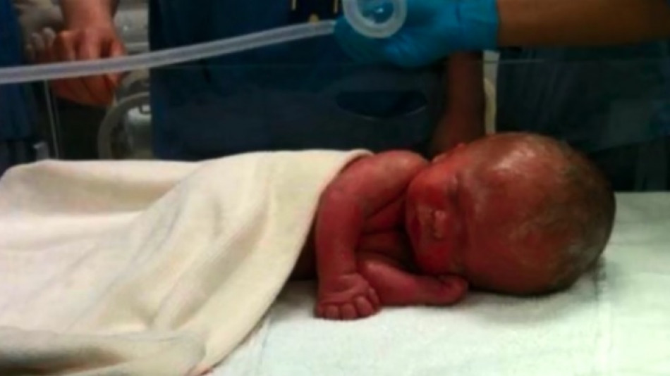 Бебето от тази СНИМКА шокира целия свят, а историята му е истинско чудо!