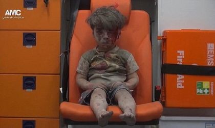 Омран: Едно дете, един кадър, хиляди емоции! (ВИДЕО, което ще ви разплаче)