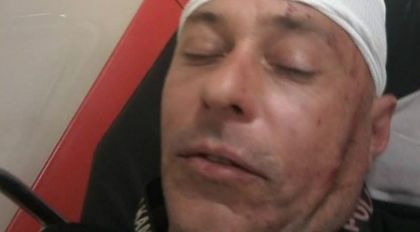 ОТ ДРУГАТА СТРАНА: Историята на Васил, пребит от група роми...
