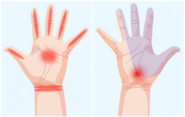 Какво разкриват ръцете за здравето ви