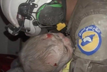 Цената на войната! Покъртително видео от Сирия разплака водещи! (ВИДЕО 18 +)
