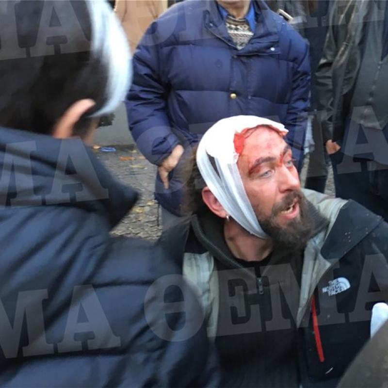 „Нова Македония“ (Македония): По време на протеста в Атина са ранени най-малко 15 души