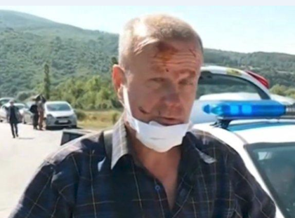 Пострадал в ада на „Тракия“: Не се виждаше на метър – пушек и мъгла!
