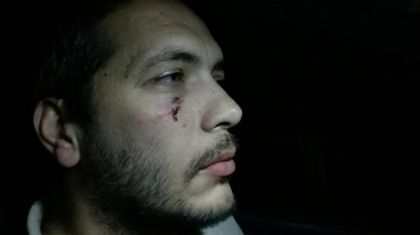 Пребиха журналисти на Нова ТВ на магистралата край Пловдив