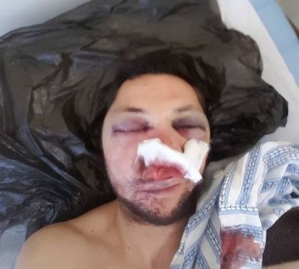 Преди няколко месеца опитали и да отровят журналиста Стоян Тончев
