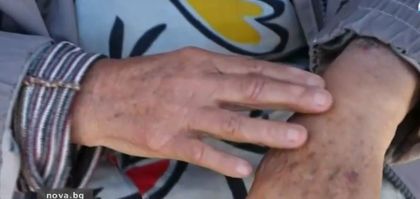 Психичноболен преби възрастна жена в Бяла