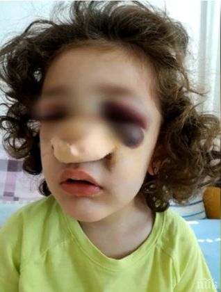 Уволниха директорка на детска градина, след като шкаф едва не уби момиченце