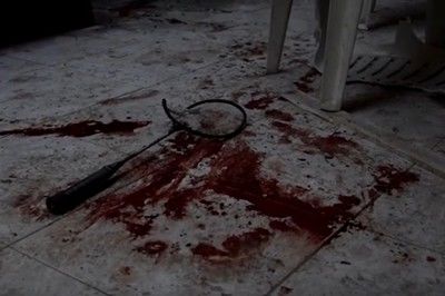 Шест деца загинаха при бомбардировка на детска градина в Сирия