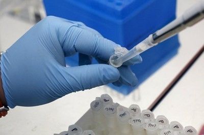 Разработиха ваксина срещу Ебола