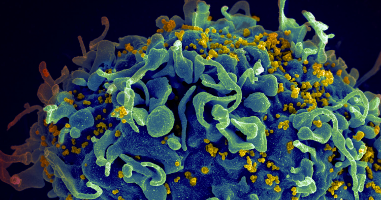 Това ли е лекът срещу ХИВ? Учени излекуваха трети пациент от смъртоносната болест