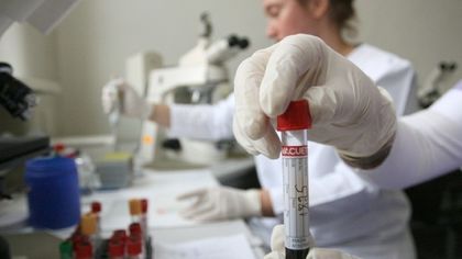 Иде ли епидемия в Пловдив? Още едно дете в болница със съмнение за морбили, болните станаха седем!