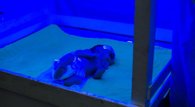 Бебе русалка се роди в Индия, почина след час