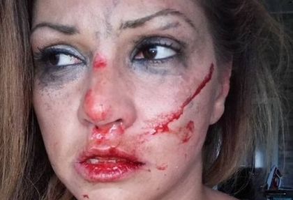 Пребитата като куче от швед Сани Алекса излъгала? (СНИМКИ 18+)